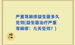 严重荨麻疹益生菌多久见效(益生菌治疗严重荨麻疹：几天见效？)