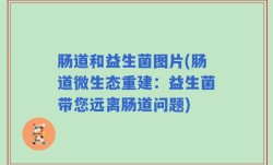 肠道和益生菌图片(肠道微生态重建：益生菌带您远离肠道问题)